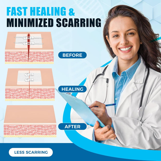 Sutures Butterfly Bandaids - 4 Pcs Laceration Closure Kit - Surgical Laceration Repair Without Sew - Quick Clot -Emergency Wound Closures Device (PU)