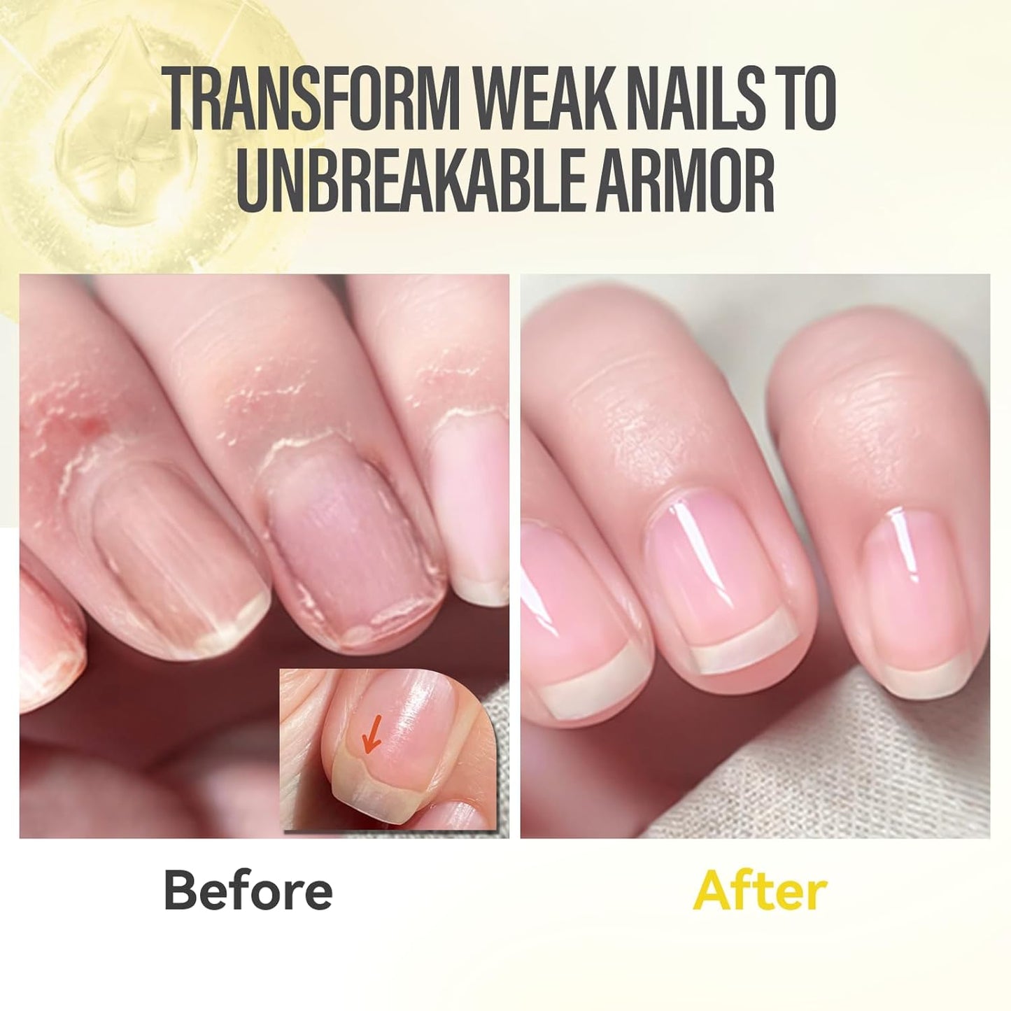 CHUCHU Nail Growth and Strengthener Oil for Cuticle - Pineapple Scent Cuticle Oil Repair Moisturizing Treatment - Natural Jojoba Vitamin B & E Nail Oil for Dry Cracked Nails