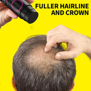 SEVICH Hair Fibers for Thinning Hair, Hair Building Fibers Instantly Thicker & Fuller Look,Hair Powder for Men & Women 25g Dark Brown