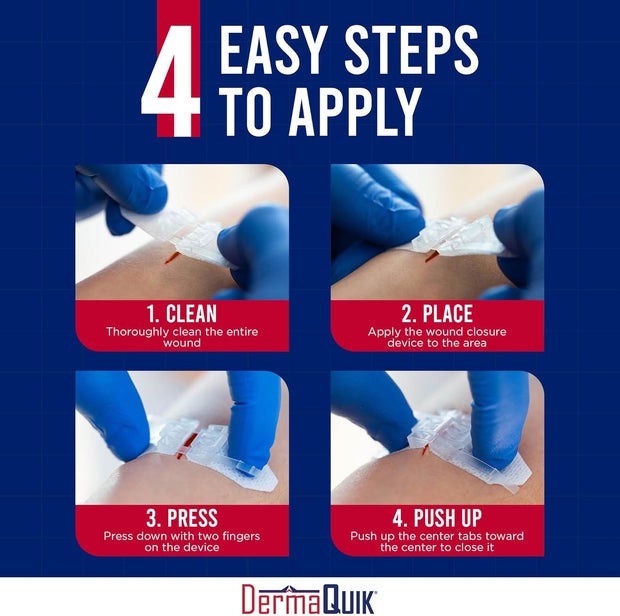 Laceration Kit - 2 Patented Laceration Closure Strips, Upgrade from Small Butterfly Bandages Wound Closure Strips, Breathable, Zip Stitchless Kit for Kids to Elderly - Home & Field Use