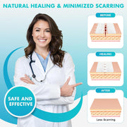 Sutures Butterfly Bandaids - 4 Pcs Laceration Closure Kit - Surgical Laceration Repair Without Sew - Quick Clot -Emergency Wound Closures Device (PU)