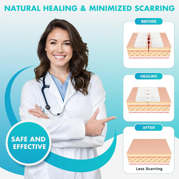 Sutures Butterfly Bandaids - 4 Pcs Laceration Closure Kit - Surgical Laceration Repair Without Sew - Quick Clot -Emergency Wound Closures Device (PU)