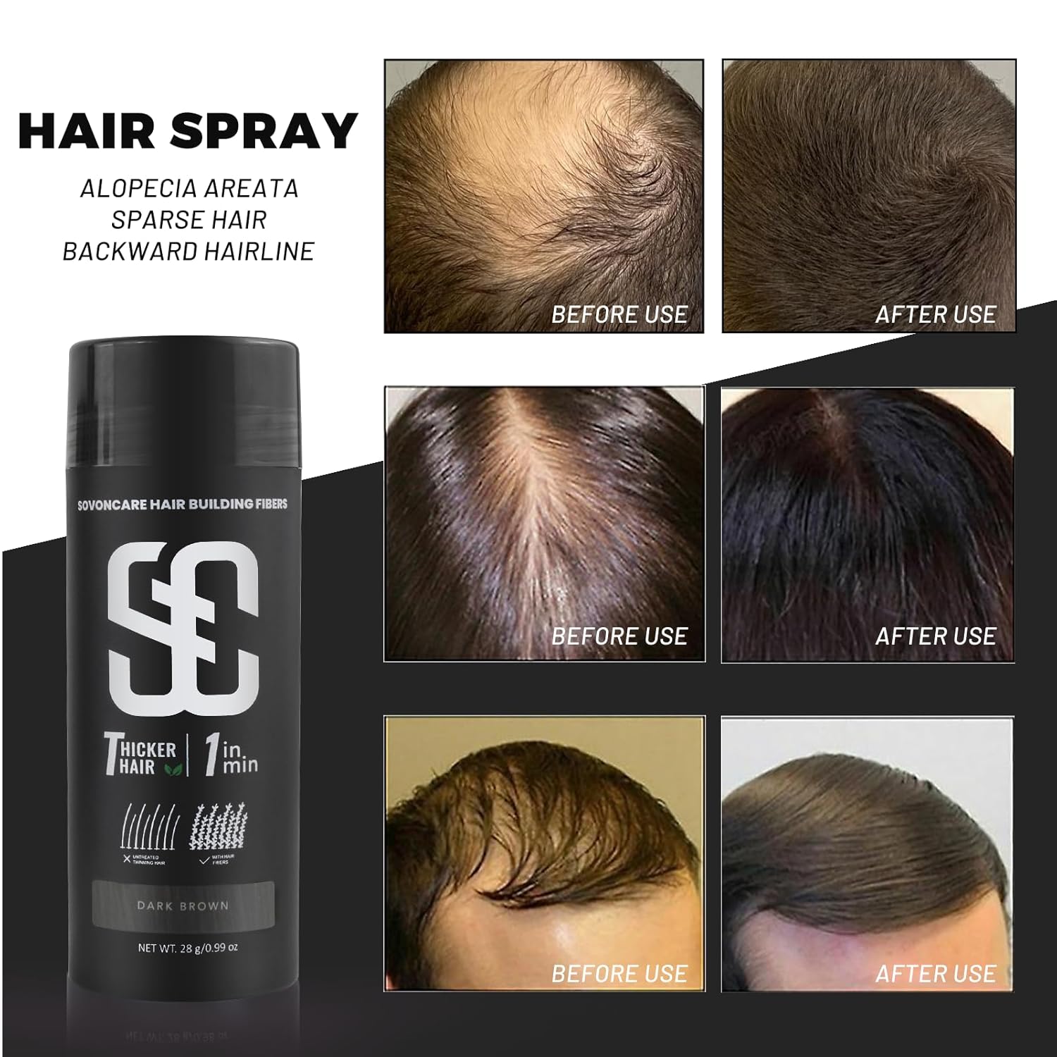 SOVONCARE Hair Fibers for Thinning Hair Dark Brown, Hair Building Fibers for Bald Spots Undetectable & Natural, Conceals Hair Loss, Fill In Fine Hair Powder Hair Thicker Instantly for Women & Men 28g