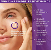 The Brightening Serum | Vitamin C Treatment for Brighter, Firmer Skin – Targets Hyperpigmentation & Fades Post-Acne Marks, 30 ml / 1.0 fl. oz.