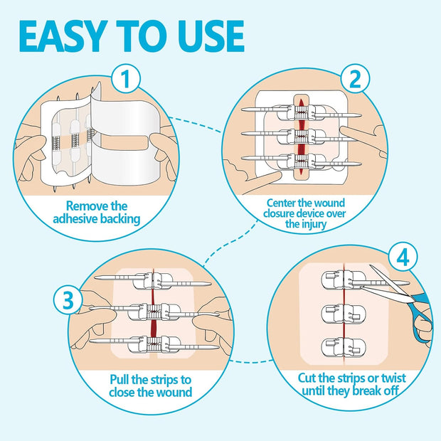 Sutures Butterfly Bandaids - 4 Pcs Laceration Closure Kit - Surgical Laceration Repair Without Sew - Quick Clot -Emergency Wound Closures Device (PU)