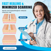 Sutures Butterfly Bandaids - 4 Pcs Laceration Closure Kit - Surgical Laceration Repair Without Sew - Quick Clot -Emergency Wound Closures Device (PU)