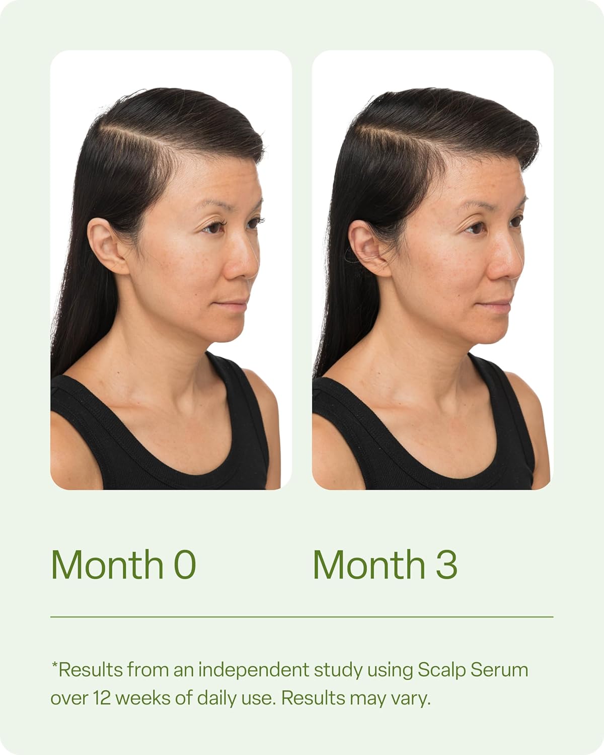 Divi Scalp Serum for Thinning Hair Clinically Tested, Nourishing Formula with Amino Acids, Caffeine & Rosemary Oil Promotes Healthy Scalp & Fuller-Looking Hair, Reduces Oil & Product Buildup