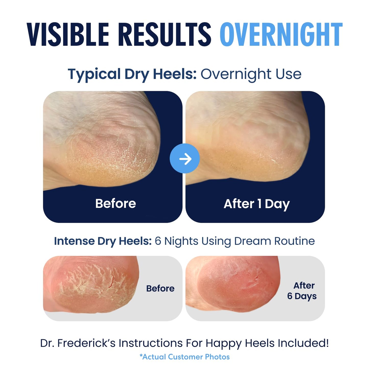 Dr. Frederick's Original Moisturizing Heel Socks for Cracked Heel Treatment - 2 Pairs - Stop Cracked Heels in Their Tracks
