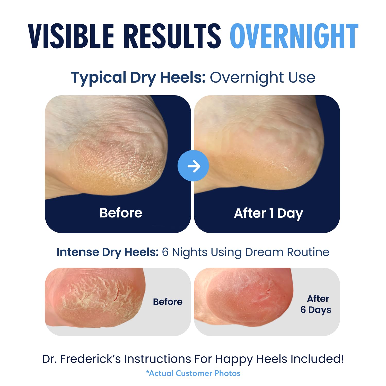 Dr. Frederick's Original Moisturizing Heel Socks for Cracked Heel Treatment - 2 Pairs - Stop Cracked Heels in Their Tracks