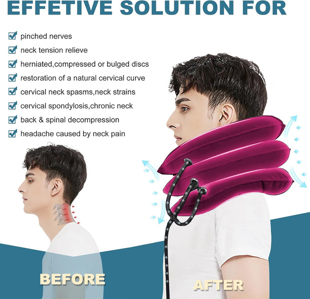 Neck Stretcher, Cervical Traction Device, Neck Traction Device, Adjustable Inflatable Neck Braces for Neck Pain and Support, Neck Stretcher Cervical Traction, Neck Decompression Home Use (Gray)