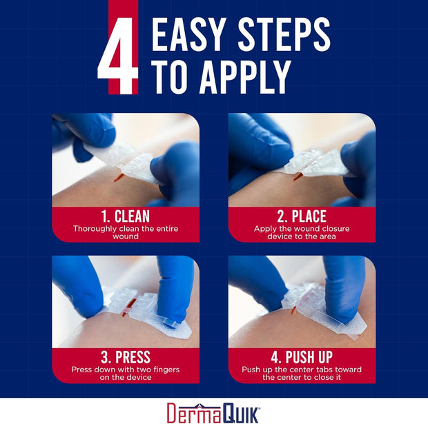 Laceration Kit - 2 Patented Laceration Closure Strips, Upgrade from Small Butterfly Bandages Wound Closure Strips, Breathable, Zip Stitchless Kit for Kids to Elderly - Home & Field Use