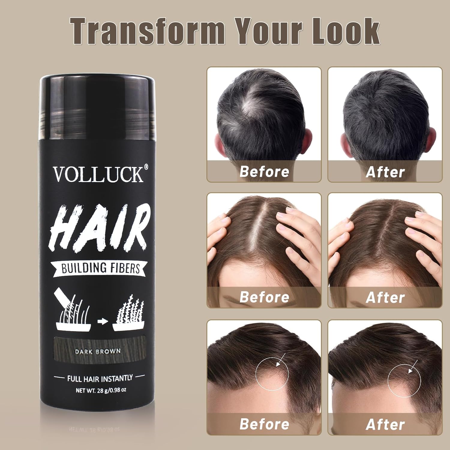 VOLLUCK Hair Fibers for Thinning Hair, Instant Coverage Hair Building Fibers for Women and men, Natural Hair Powder for Conceal Hair Loss 28 g (Dark Brown)