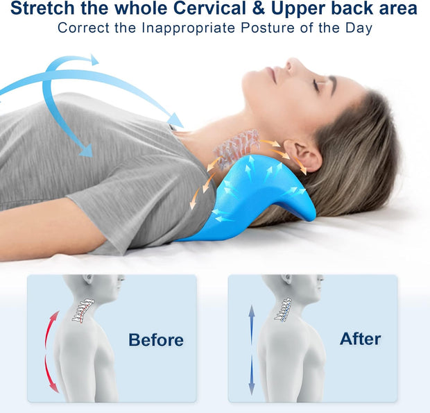 Neck and Shoulder Relaxer with Upper Back Massage Point, Cervical Traction Device Neck Stretcher for TMJ Pain Relief and Cervical Spine Alignment Chiropractic Pillow (Grey)