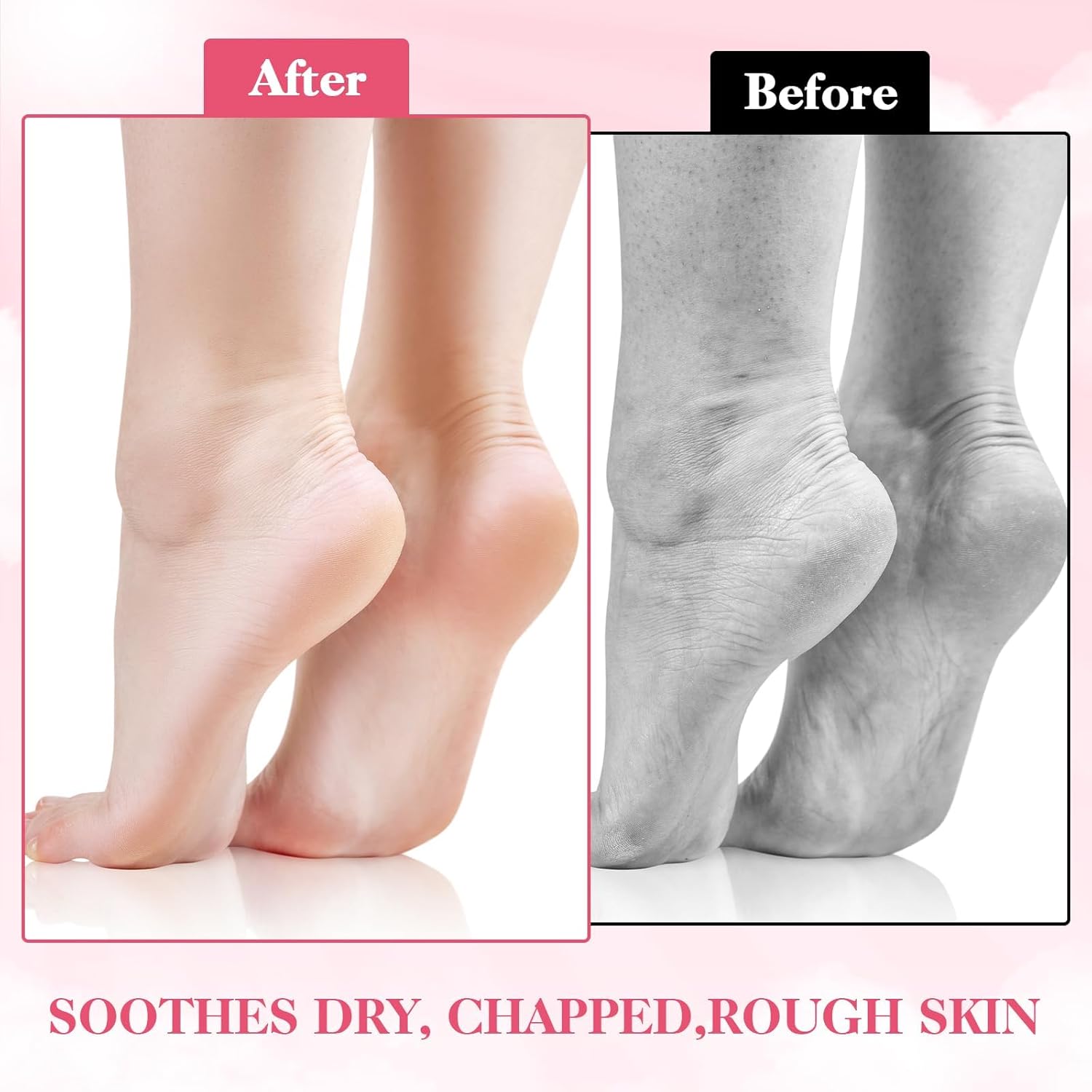 3 Pairs Moisturizing Socks Overnight, Spa Socks for Dry Feet, Cotton Moisture Enhancing Socks, Lotion Socks for Cracked Heel Repair, Cosmetic Moisturizing Socks for Women White