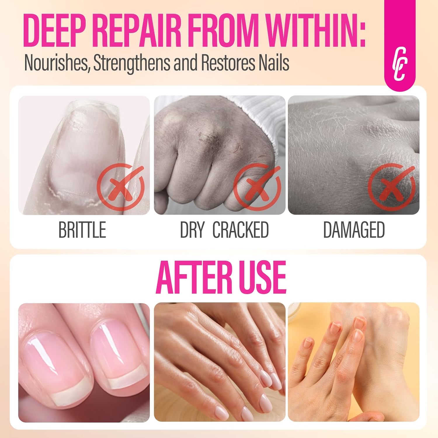 CHUCHU Nail Growth and Strengthening Serum: Fast Absorbing Honey Milk Fragrance Protein – Cuticle Care Treatment for Women Men Professional Home - Ideal Gift for Nail Care Enthusiasts