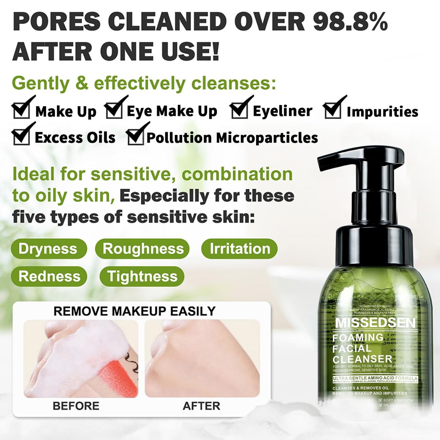 Face Wash for Acne, Oily & Sensitive Skin all Skin Types Oil Control and Hydrating Foaming cleanser No Fragrance/Dye/Soap (300ml/10oz)