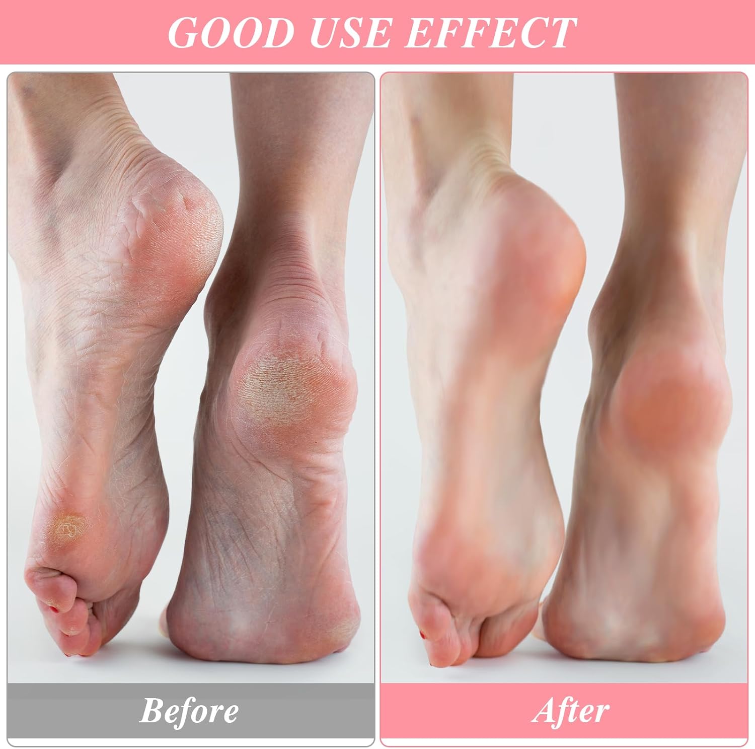 3Pairs Aloe Socks Moisturizing Spa Socks Sleeping Fuzzy Socks for Dry Feet Overnight, Non Slip Coral Fleece Lotion Socks Women Spa Pedicure Foot Care Socks for Repairing Dry Feet,Cracked Heel
