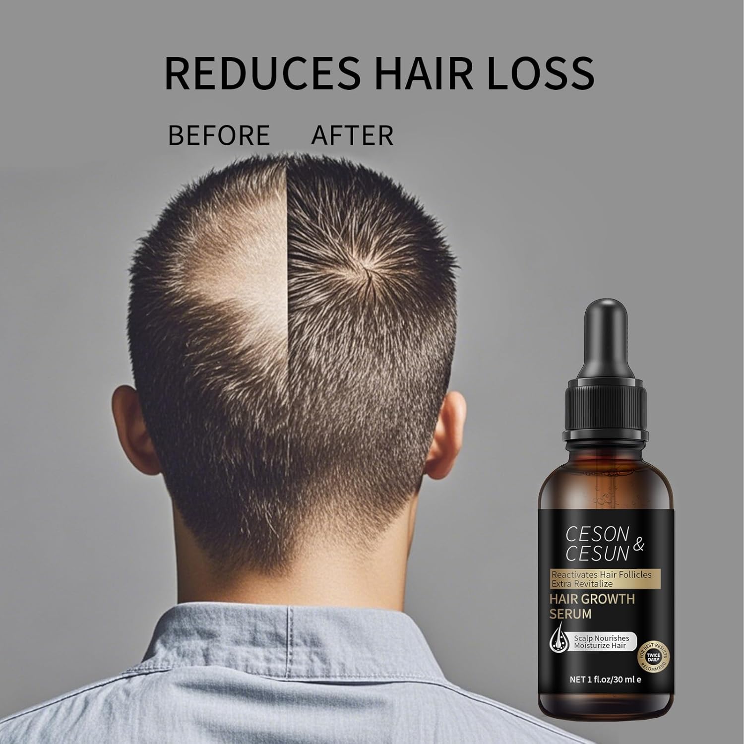 Ceson&Cesun Hair Growth Serum/Scalp Oil, With Biotin & Rosemary Castor Oil, Hair Thickening Serum For Hair loss, Water-Based, Nourishes The Scalp, Natural Hair Regrowth & Dry Damaged Hair Treatment