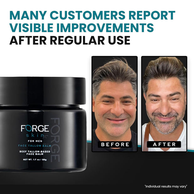The Forge Skin Men's Beef Tallow Balm for Skin | Beef Tallow for Skin Face Mens Skin Care Cream Facial Skincare Face Moisturizer for Men