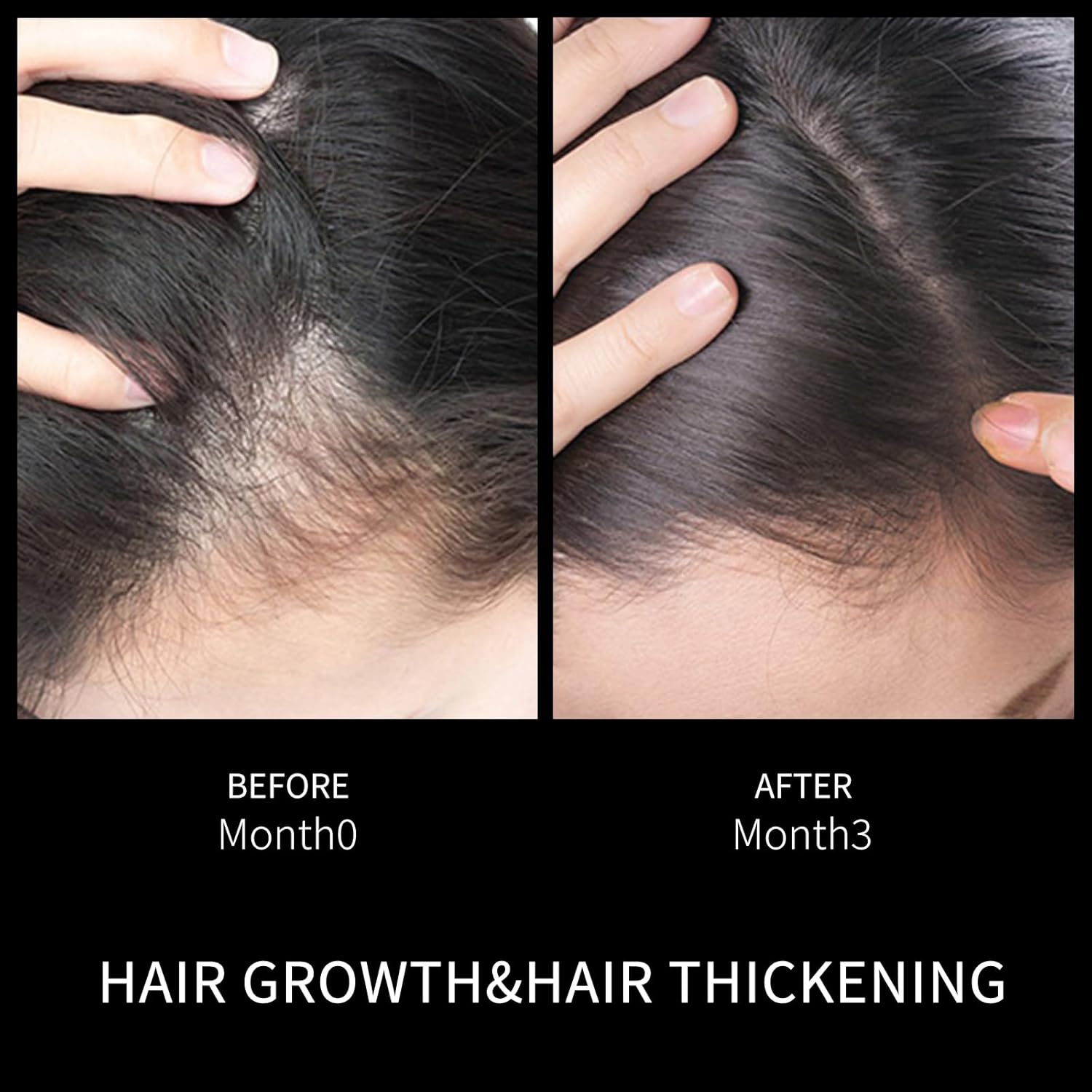 Ceson&Cesun Hair Growth Serum/Scalp Oil, With Biotin & Rosemary Castor Oil, Hair Thickening Serum For Hair loss, Water-Based, Nourishes The Scalp, Natural Hair Regrowth & Dry Damaged Hair Treatment