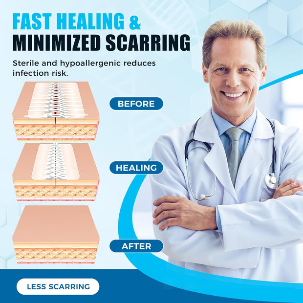 Sutures Butterfly Bandaids - 4 Pcs Laceration Closure Kit - Surgical Laceration Repair Without Sew - Quick Clot -Emergency Wound Closures Device (PU)