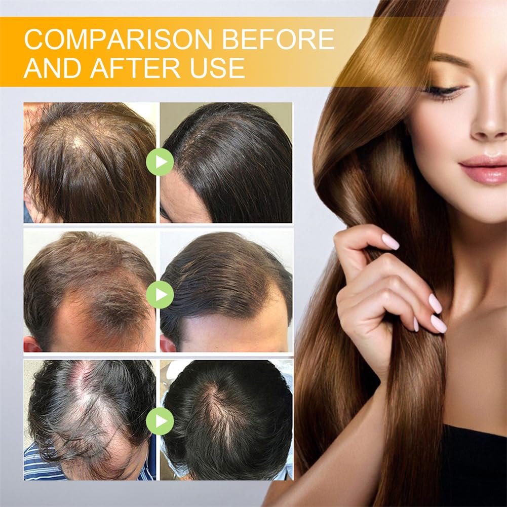 Moonbiffy Biotin Premium Hair Growth Serum for Thicker, Longer & Stronger Hair (2PCS)