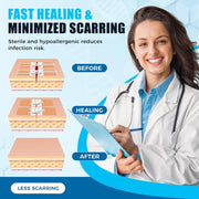 Sutures Butterfly Bandaids - 4 Pcs Laceration Closure Kit - Surgical Laceration Repair Without Sew - Quick Clot -Emergency Wound Closures Device (PU)