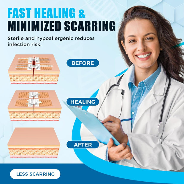 Sutures Butterfly Bandaids - 4 Pcs Laceration Closure Kit - Surgical Laceration Repair Without Sew - Quick Clot -Emergency Wound Closures Device (PU)