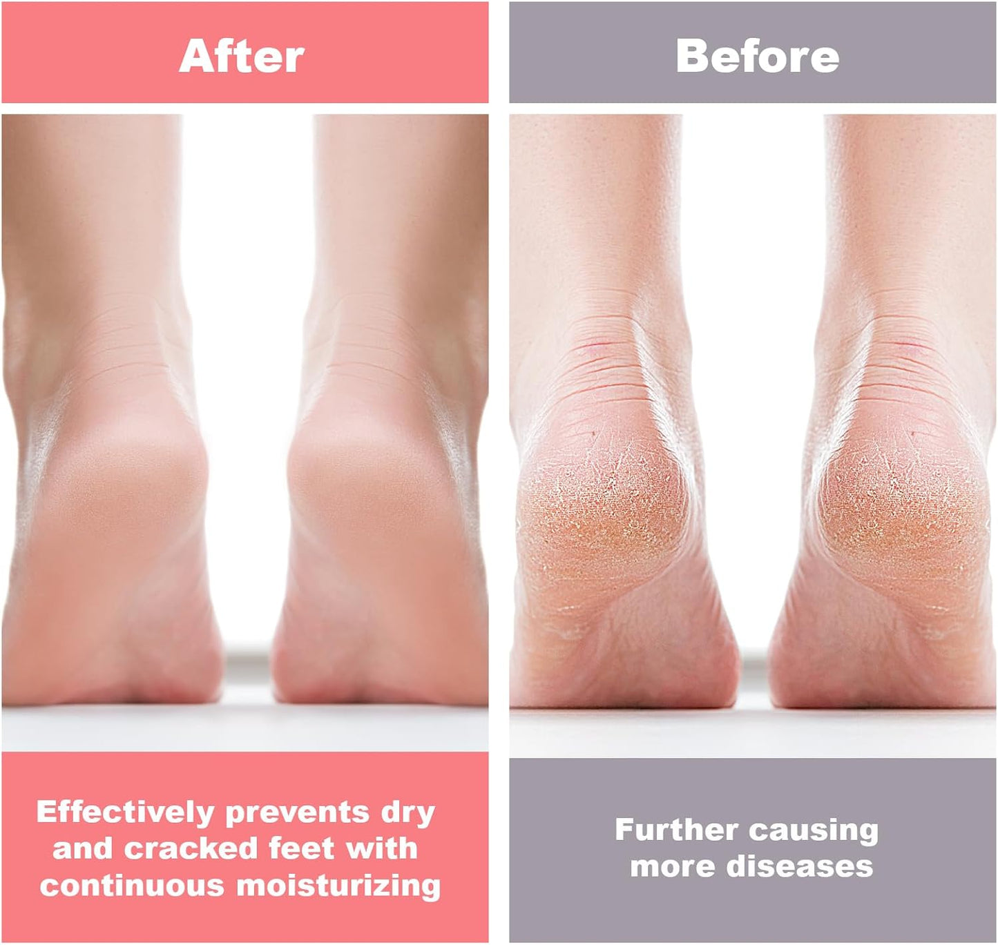 Silicone Socks for Dry Cracked Feet Women,New Upgrade Thickened Moisturizing Foot Mask Exfoliating Silicone Socks,2 Pairs Spa Gel Moisturizer Socks Foot Care After Pedicure,Large