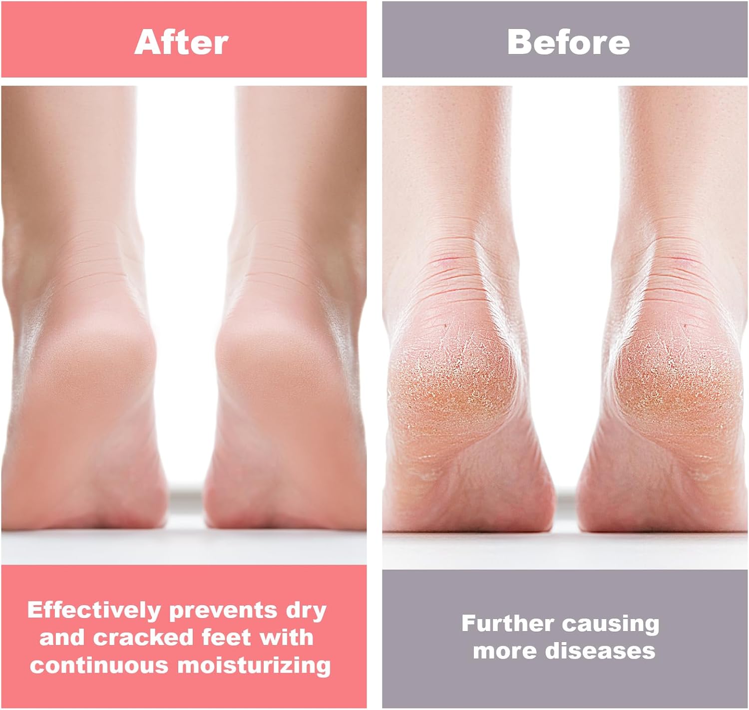Silicone Socks for Dry Cracked Feet Women,New Upgrade Thickened Moisturizing Foot Mask Exfoliating Silicone Socks,2 Pairs Spa Gel Moisturizer Socks Foot Care After Pedicure,Large
