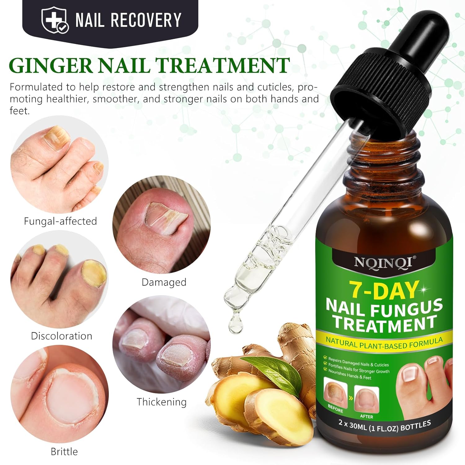 7 Days Nail Fungus Treatment, Fungi Nail Liquid Maximum Strength, Ginger Cuticle Care Oil for Strengthen & Promote Nail Growth (2PCS)