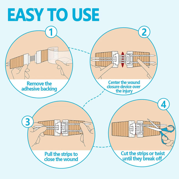 Sutures Butterfly Bandaids - 4 Pcs Laceration Closure Kit - Surgical Laceration Repair Without Sew - Quick Clot -Emergency Wound Closures Device (PU)