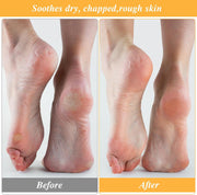 3 Pairs Moisturizing Socks for Dry Feet, Cracked Heel Repair - Overnight Lotion Cotton Socks, Gel Spa Moisture Enhancing for Women and Men, White