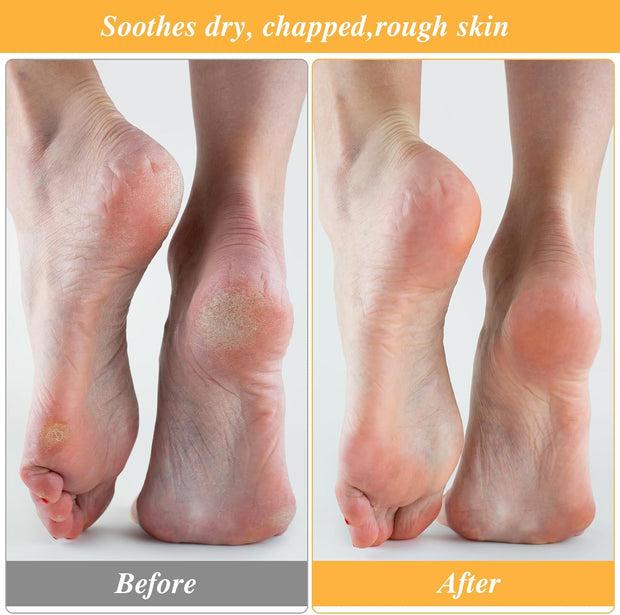 3 Pairs Moisturizing Socks for Dry Feet, Cracked Heel Repair - Overnight Lotion Cotton Socks, Gel Spa Moisture Enhancing for Women and Men, White