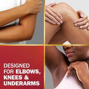 Olay Treatment Cream Intensive Tone Correcting for Elbows Knees & Underarms with Niacinamide, Vitamin B3 Complex, Deeply Hydrates, Evened Skin Tone, 1.7 fl oz