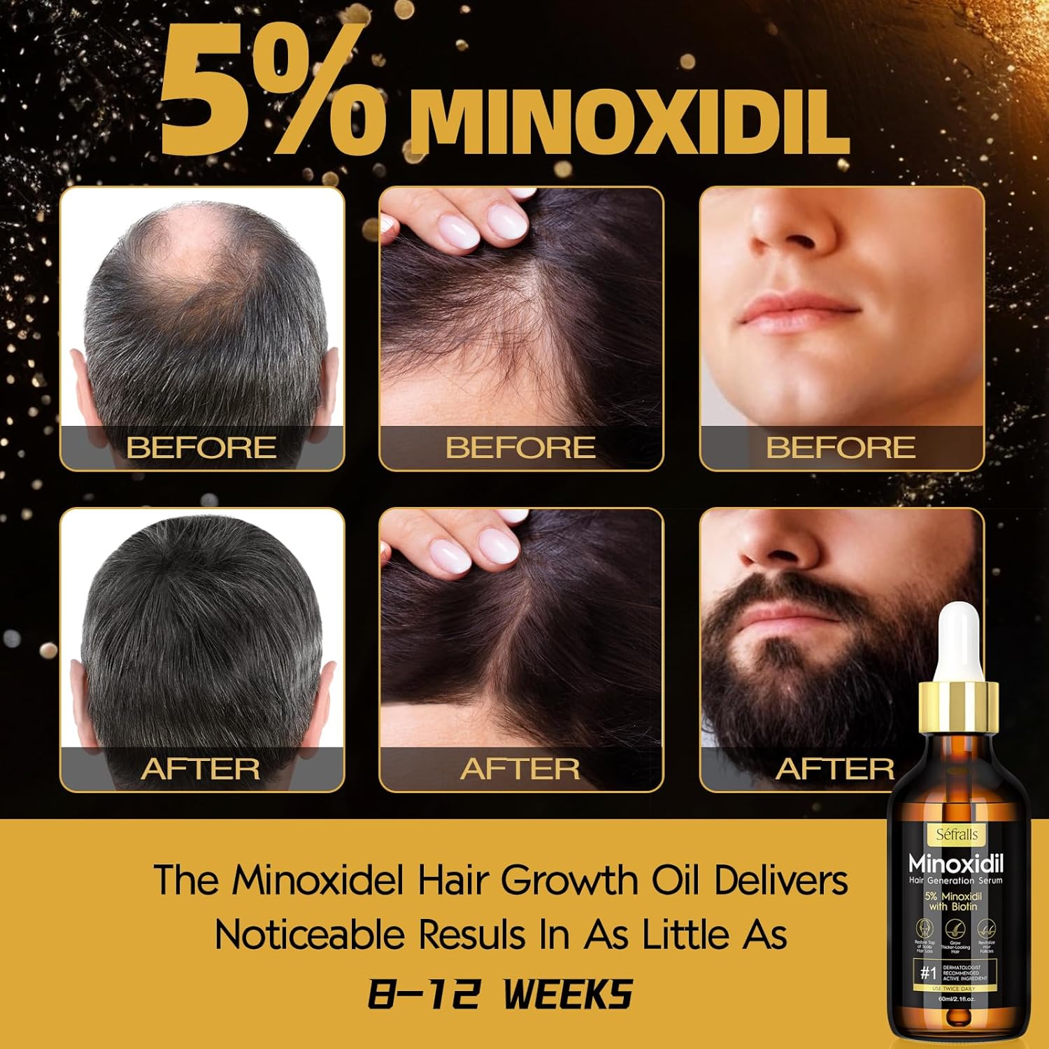 5% Minoxidil Hair Growth Serum Oil For Men and Women, Biotin Hair Serum, Safest Hair Regrowth Treatment, Prevent Scalp Hair Loss 60ml / 2.11 fl.oz