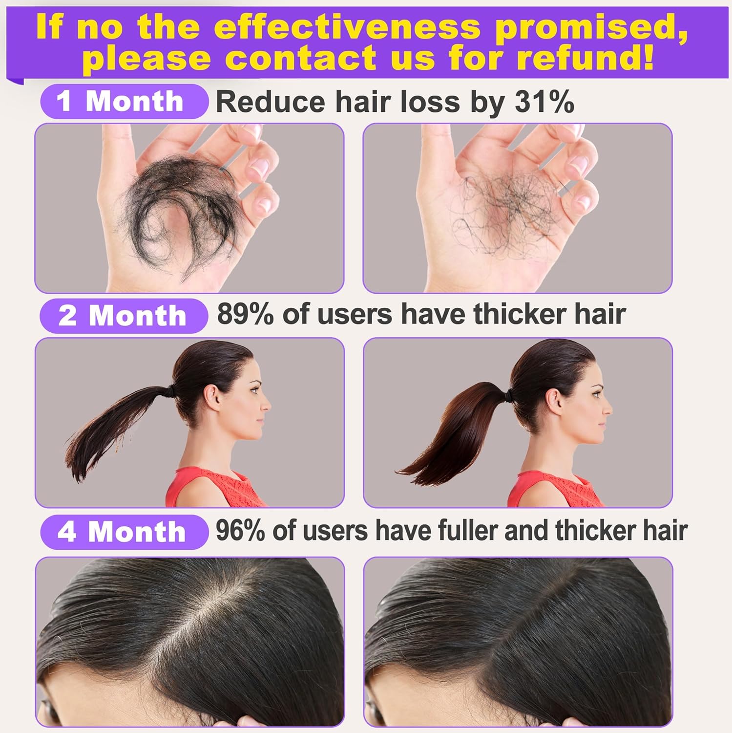 GOLDWORLD Rosemary Oil for Hair Growth,2 Pack Growth Serum Products w/Scalp Massager Castor Biotin Argan Thinning Dry Damaged Ingrown Regrowth Loss Treatment Women Men