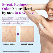 Zero Trace Travel Deodorant Wipes - 60 Count- 24 Hour Odor Control - Aluminum Free Hypoallergenic Deodorant For Women and Men - Individually Wrapped Underarm & Body Wipes - Uscented Bare Fresh