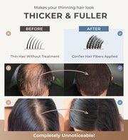 Keratin Hair Fibers for Men & Women - Fill In Fine or Thinning Hair, Instantly Thicker, Fuller Looking Hair (Black, 15g)