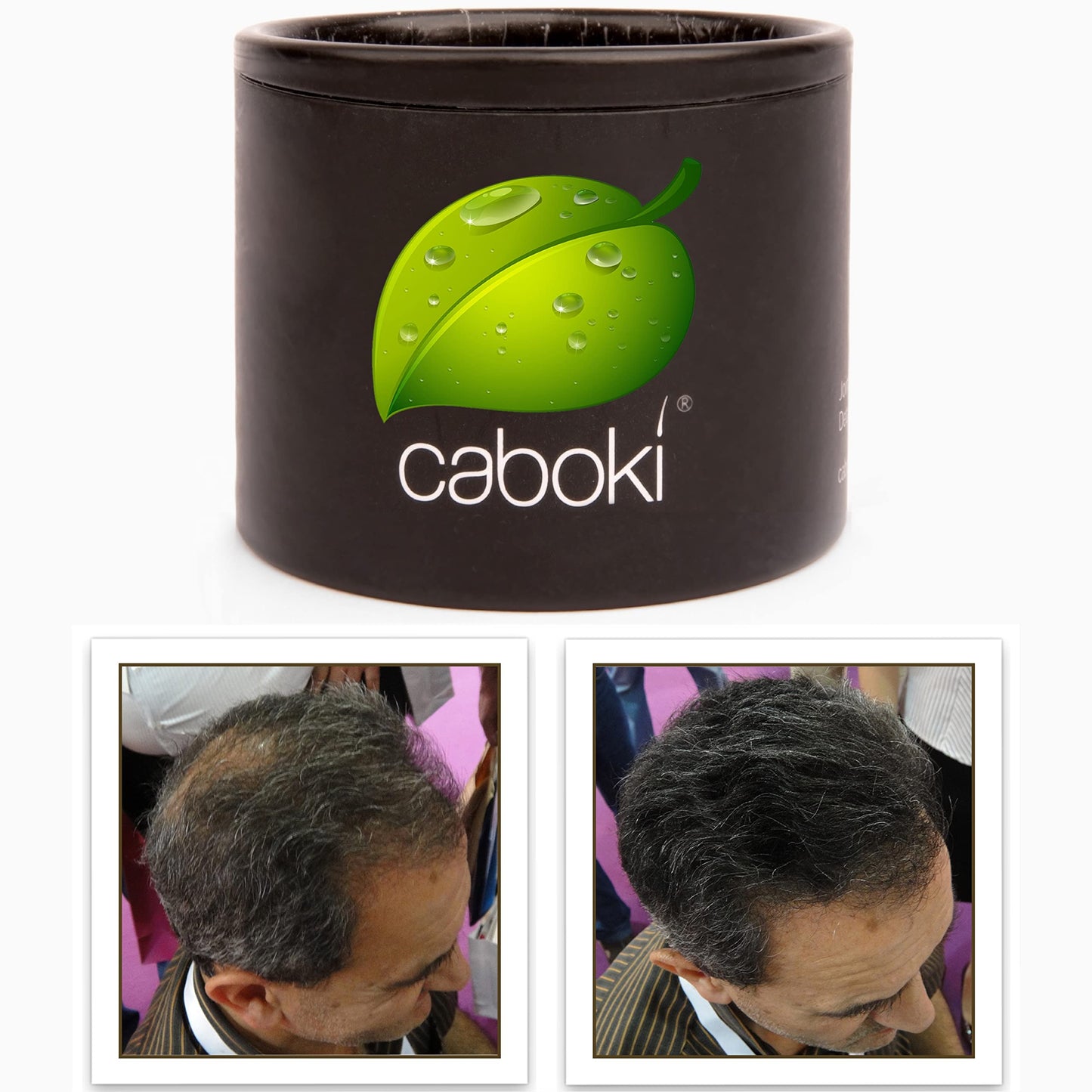 Hair Thickening Fibers. Cover Bald Spot and Thinning Hair Instantly. Make Thin Hair Look 10X Fuller. All-Natural Hair Building Fiber. Trial Size (10-Day Supply). Silver/White