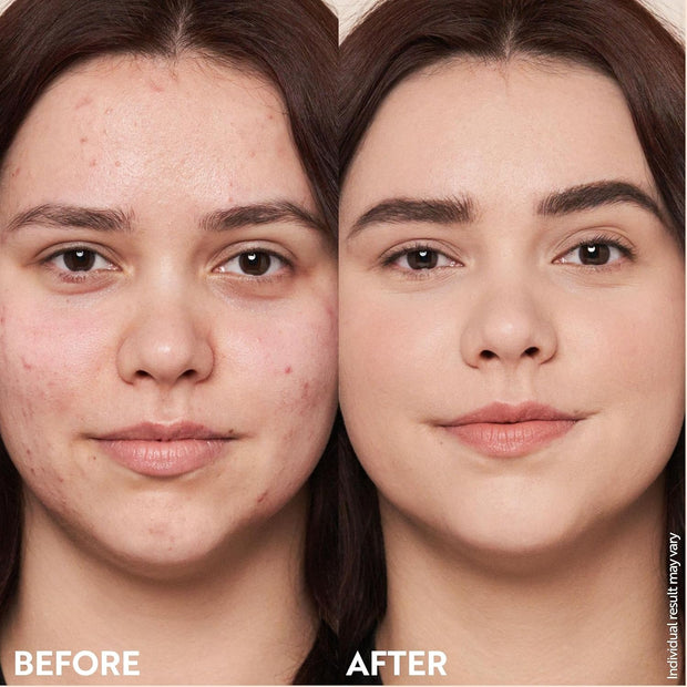 M. Asam Magic Finish Make-Up Mousse (1.01 Fl Oz) – 4in1 Primer, Foundation, Concealer & Powder With Buildable Coverage, Hides Redness And Dark Spots, Vegan, For Light To Medium Skin Tones