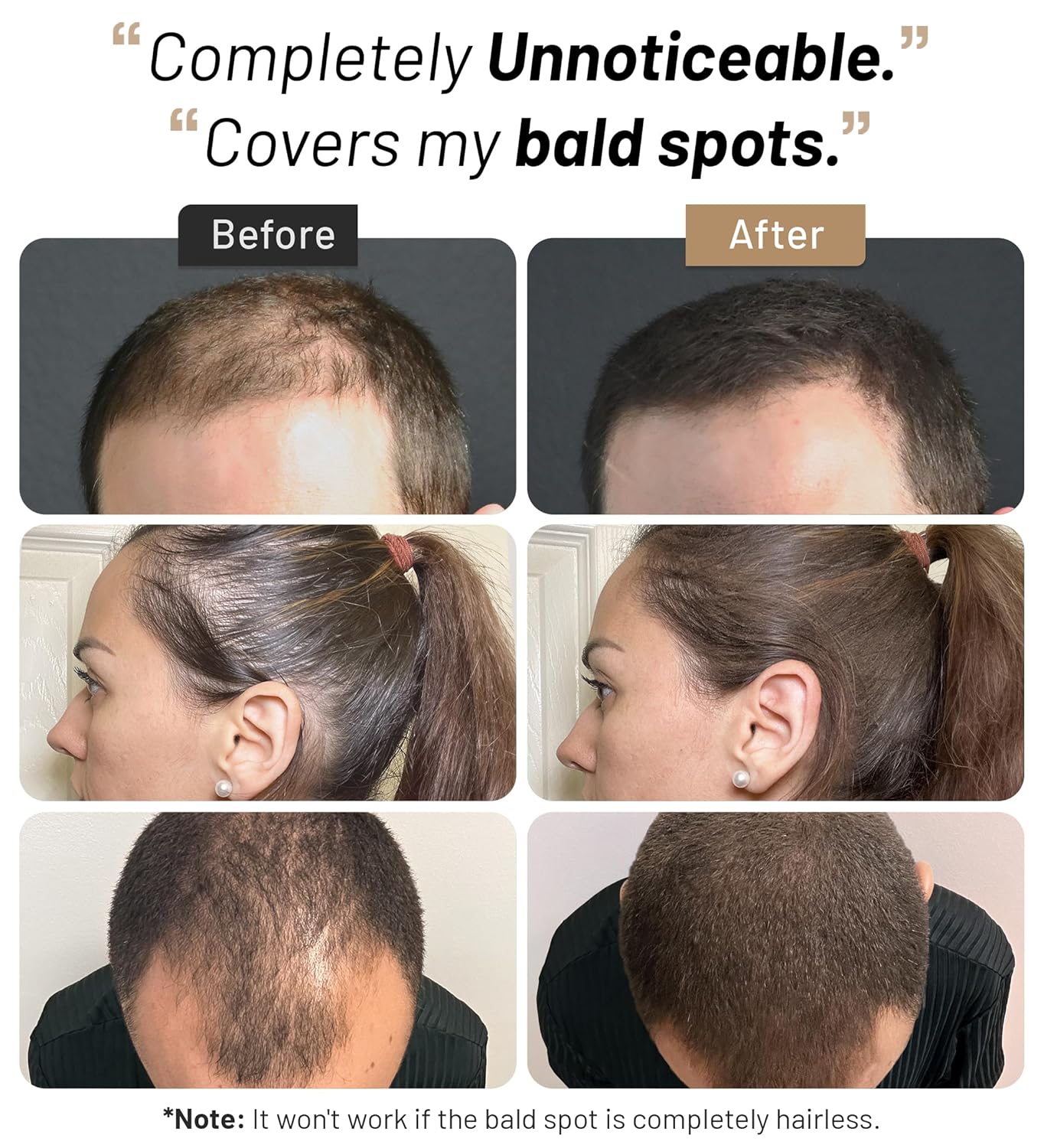 Hair Fibers for Men & Women (30 Grams, Black), Fill In Fine or Thinning Hair, Instantly Thicker, Fuller Looking Hair