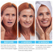 Retinol Cream for Face with Hyaluronic Acid, Anti Aging Wrinkle Cream for Women and Men, Day and Night Collagen Moisturizer to Minimize Wrinkles, Dryness, 1.85 Oz