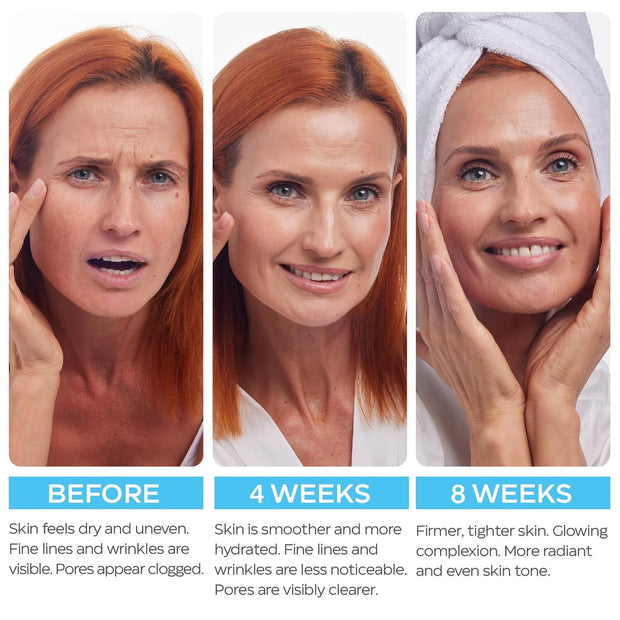 Retinol Cream for Face with Hyaluronic Acid, Anti Aging Wrinkle Cream for Women and Men, Day and Night Collagen Moisturizer to Minimize Wrinkles, Dryness, 1.85 Oz