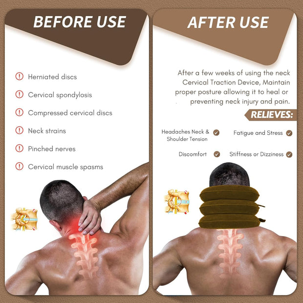 Neck Stretcher, Cervical Traction Device, Neck Traction Device, Neck Pain Relief, Adjustable Inflatable Neck Brace & Neck Stretcher Cervical Traction, Neck Decompression Home Use (Purple)