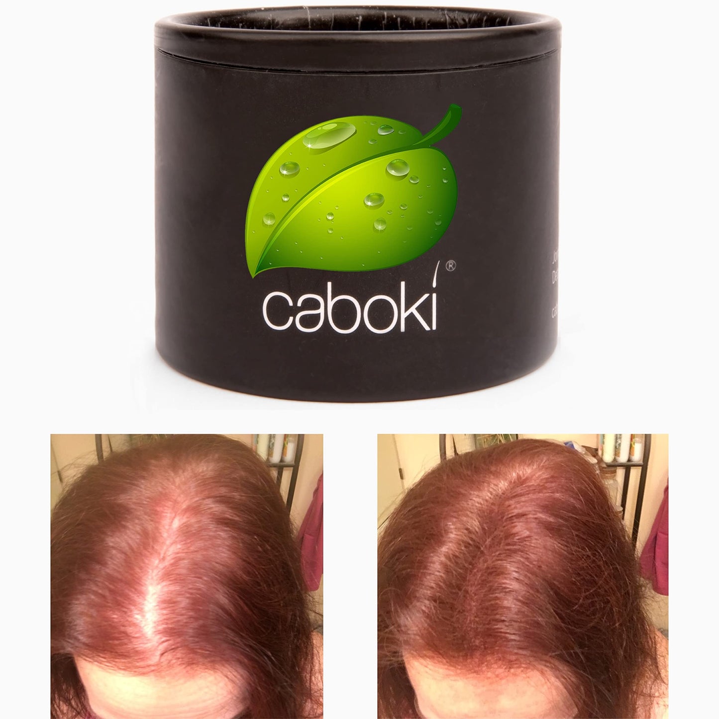 Hair Thickening Fibers. Cover Bald Spot and Thinning Hair Instantly. Make Thin Hair Look 10X Fuller. All-Natural Hair Building Fiber. Trial Size (10-Day Supply). Silver/White