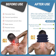 Neck Stretcher, Cervical Traction Device, Neck Traction Device, Neck Pain Relief, Adjustable Inflatable Neck Brace & Neck Stretcher Cervical Traction, Neck Decompression Home Use (Purple)