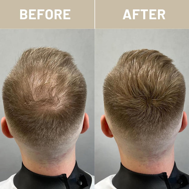 VOLLUCK Hair Fibers for Thinning Hair, Instant Coverage Hair Building Fibers for Women and men, Natural Hair Powder for Conceal Hair Loss 28 g (Dark Brown)