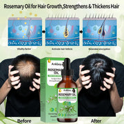 3 Pack Rosemary Oil for Hair Growth,Rosemary Hair Growth Oil,Hair Strengthening Serum for Dry Damaged Hair,Hair Loss Treatment & Thickens Hair,Scalp Care Promotes Hair Thickness for Men Women