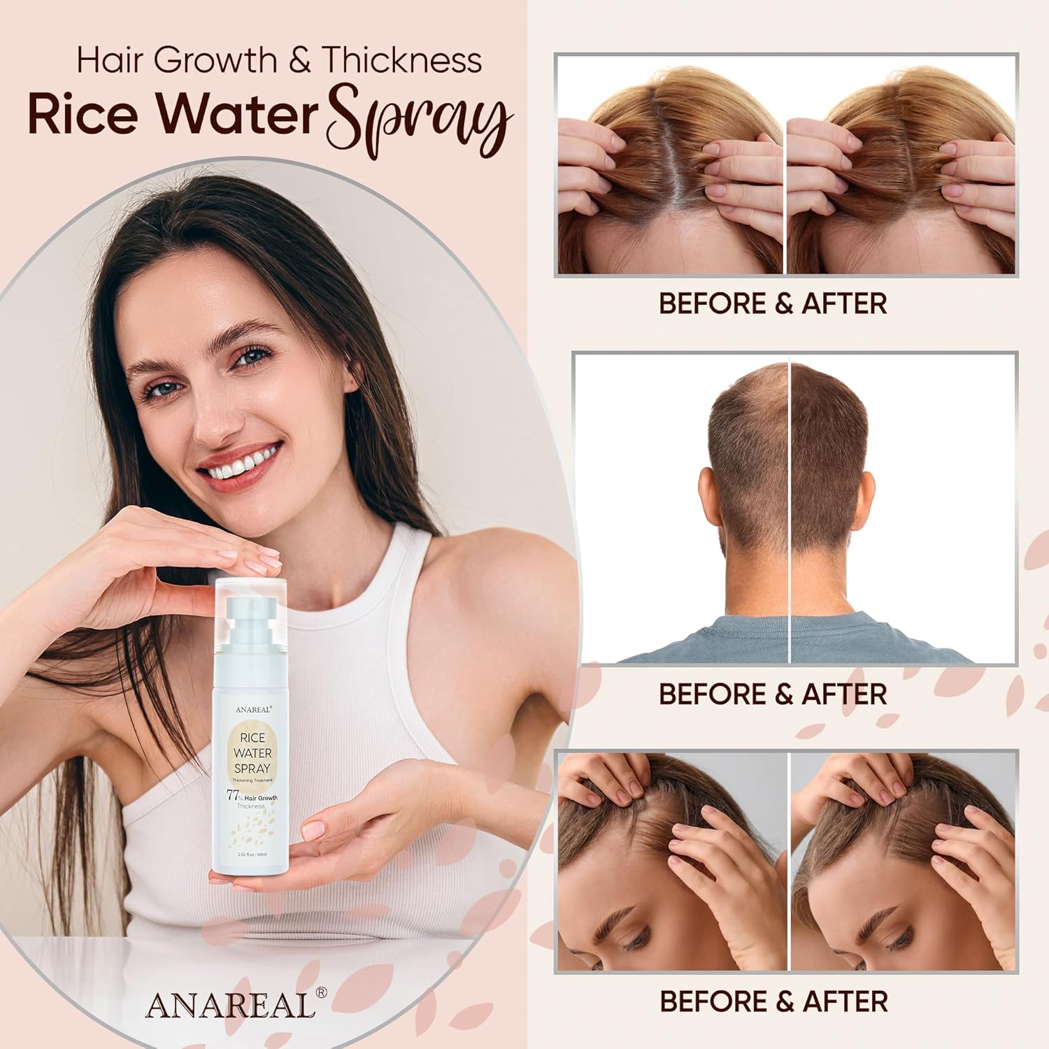 Hair Growth Serum, Rice Water for Hair Growth, Rice Water Hair Spray, Hair Growth Oil Spray for Women infused with Castor Oil and Biotin 2oz